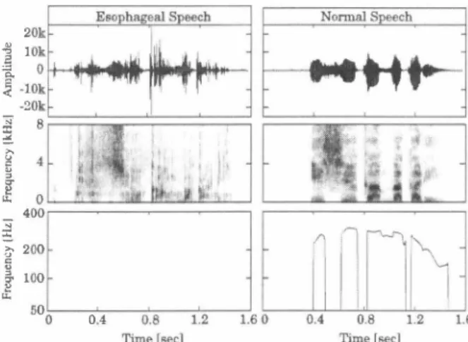 Fig.  1.  Example of waveforms. spectrograms and  Fo  contours of 