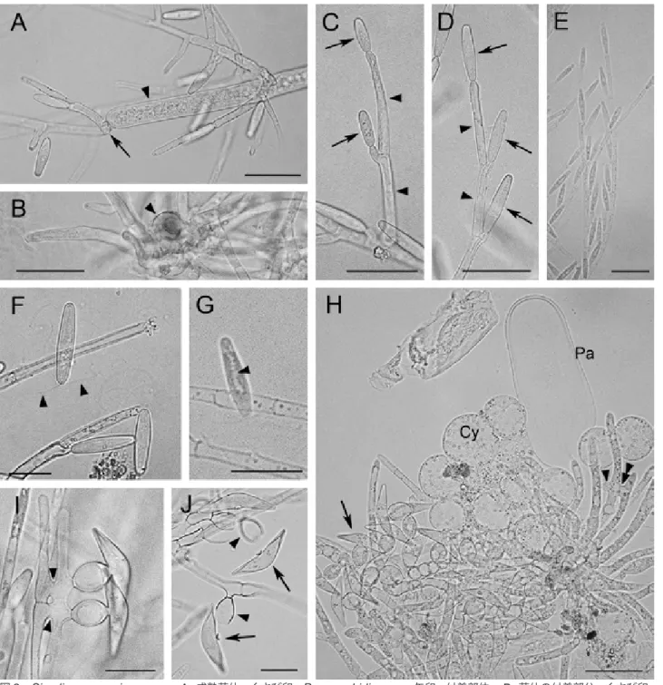 図 2.   Simuliomyces microsporus . A.  成熟菌体 .  くさび印 :  Paramoebidium  sp.,  矢印 :  付着部位 ;  B