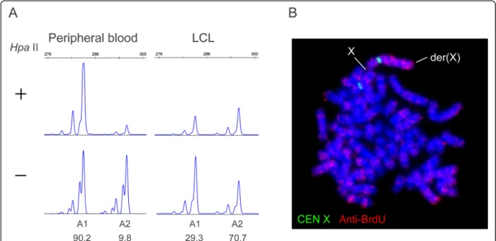 Fig. 2 XCI patterns in the peripheral blood and LCL of the study patient. (a) HUMARA assay
