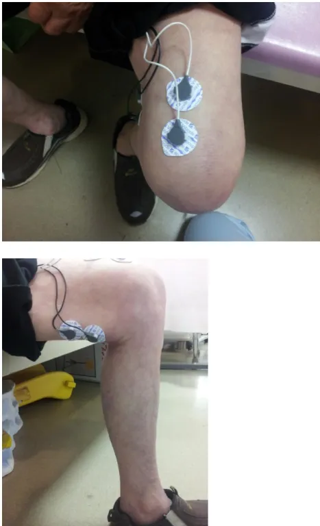 図 9：膝関節屈曲筋・伸展筋に電極を貼付している様子 