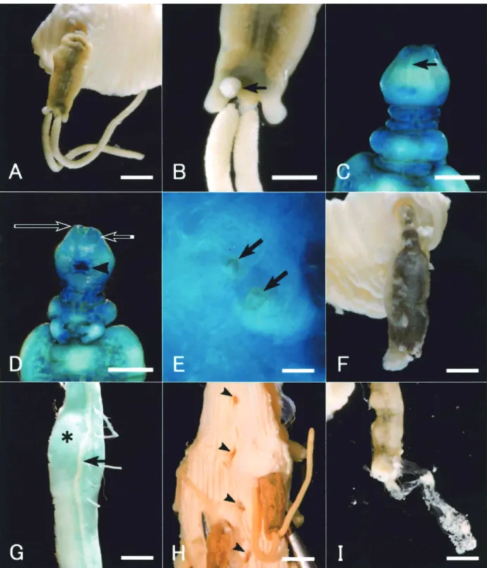 Fig. 2. 　   Acanthochondria eptatreti from the pharynx of hagﬁsh. All specimens were ﬁxed with 10%fromalin in distilled water (A- (A-F), 10%fromalin in sea water (H) or Davidson ’ s solution 5)  (G &amp; I)