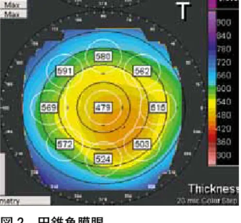 図 2   円錐角膜眼