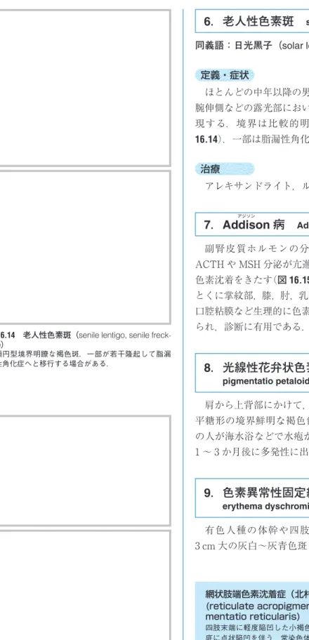 図 16.15　Addison 病（Addison’s disease）