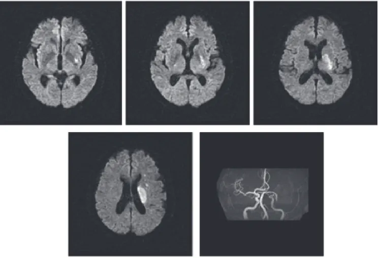 Fig. 1  Brain magnetic resonance imaging and angiography.