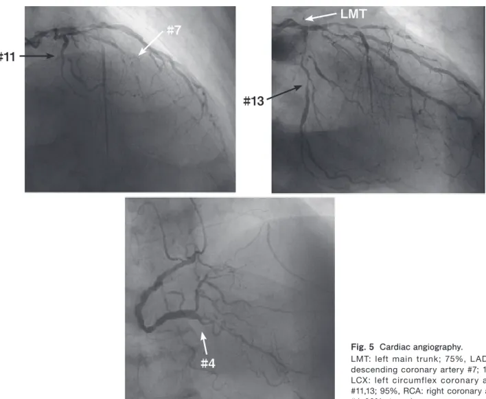 Fig. 5  Cardiac angiography. 