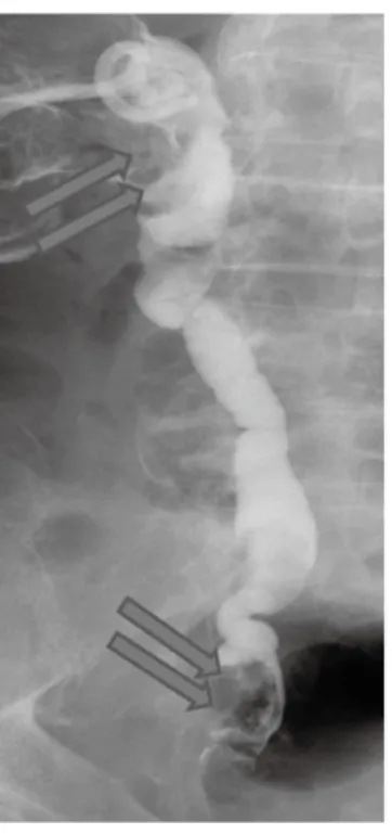 図 2. 腹部 CT 検査 ( 化学療法前 )