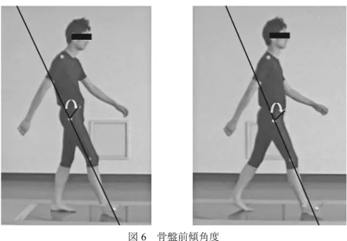 図 6   骨盤前傾角度 * 上前腸骨棘と大転子を結ぶ線分が、大転子と膝関節外側関節裂隙を結ぶ線分とのなす鋭角角度(°) 図 7   骨盤の推進性  －骨盤～体幹との位置関係－ * 上前腸骨棘からの垂線が、上前腸骨棘と肩峰を結ぶ線分とのなす鋭角角度（°）   体幹部回旋運動前後における麻痺側 swing 動作の変化をデータの正規性を確認してから対 応のある t 検定を用い、有意水準を 5% として解析を行った。なお統計学的解析には、 Microsoft 社製表計算等ソフトウェア（ Microsoft Exc