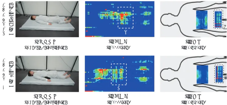 Fig. 8 Visualized sample image of pressure distribution with and without cushion in supine position without cushion with cushion (iii) Cloth-type(ii) Sheet-type(i)Experimental situation (iii) Cloth-type(ii) Sheet-type(i)Experimental situation(iii) 衣類クッションあ