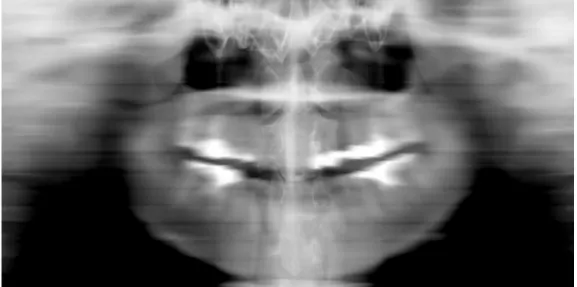 Fig. 3.11: スケーリング後の頸椎画像