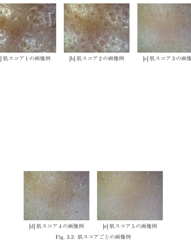 Fig. 3.2: 肌スコアごとの画像例