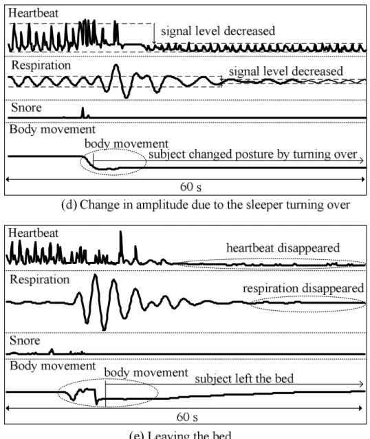 Fig. 4 Typical biosignals measured by the pneumatic method  Fig.4(a) は 2006 年 2 月 10 日の 5 ： 11 ～ 5 ： 12 の一分間のリアルタイムで計 測された波形である．脈波，呼吸とも周期的で安定しており，体動も発生して いないため，深い睡眠であると考えられる．このように脈波，呼吸が安定した 状況では，脈波の一拍ごとの R-R 間隔や，一呼吸ごとの周期を正確に読み取る ことが可能である．また，一分間の 600 点のうち，5