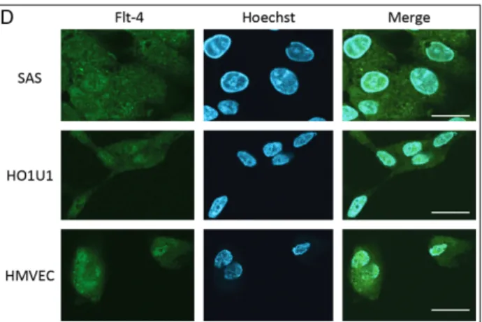 Figure 1. Baseline mRNA expression of Flt-4, VEGF-C, and CNTN-1 in HNSCC cells. The mRNA expression levels of  each gene in the HNSCC cell lines were assessed by quantitative real-time PCR