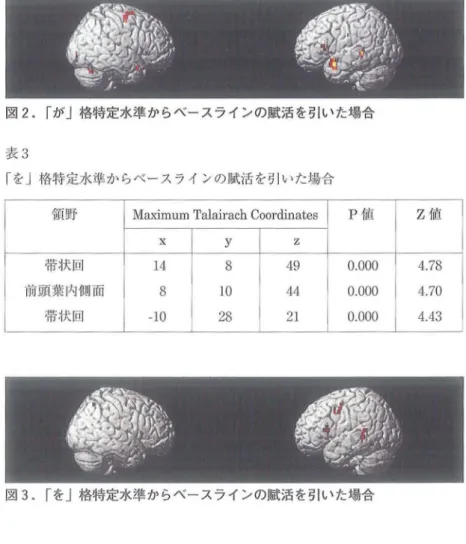 図 2 . r が」格特定水準からベースラ インの賦活を引いた場合 表 3 「 を J 格特定水準からベースラインの J ! 武活 を ヲ ￨ いた場合 領野 Maximum  T a l a i l ' a c h  C o o r d i n a t e s  P 値 Z 値 X  y  Z  帯 ; 1 犬巨￨ 1 4  8  4 9  0 