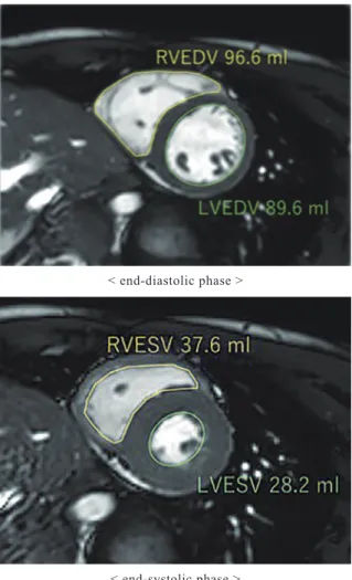 Figure 1    The images of the measurement of the EDV/ESV