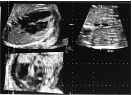 Figure 1  Spatiotemporal image correlation images (normal case) 