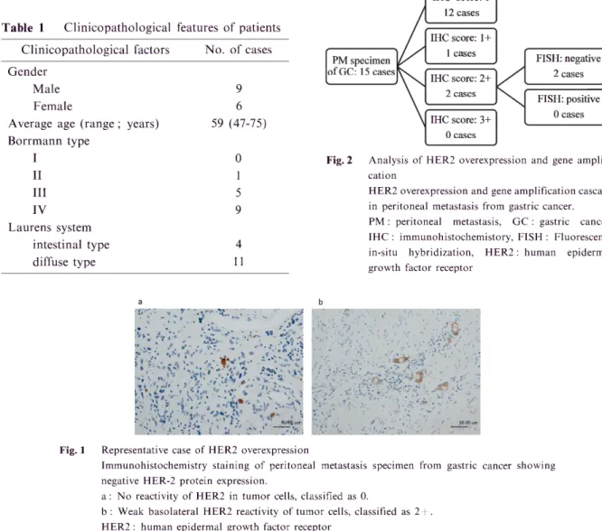 Fig.  2 Analysis  of  HER2  overexpression  and  gene  amplifi- amplifi-cation 