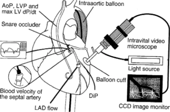 Fig.  1  Schematic  drawing  of  animal  preparation  and  measurements.  Intraaortic  balloon  pumping  was  introduced  in  the  thoracic  aorta  and  needle-probe  of  the  microscope  was  placed  on  the  epicardial  surface