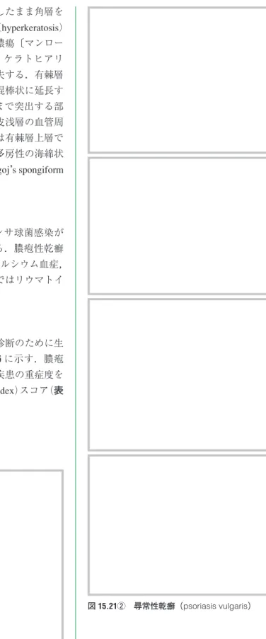表 15.6　乾癬の鑑別疾患