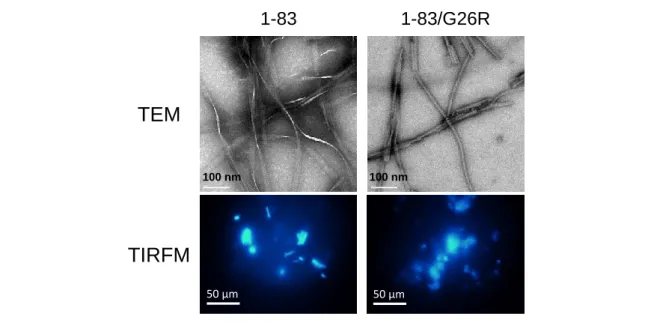 Figure  1-3  水溶液中で形成されたアミロイド線維の形態観察.  TEM  and  TIRFM 