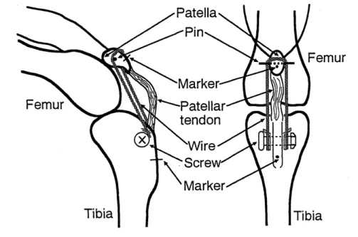 Fig.  9  Method  for  stress  shielding. 