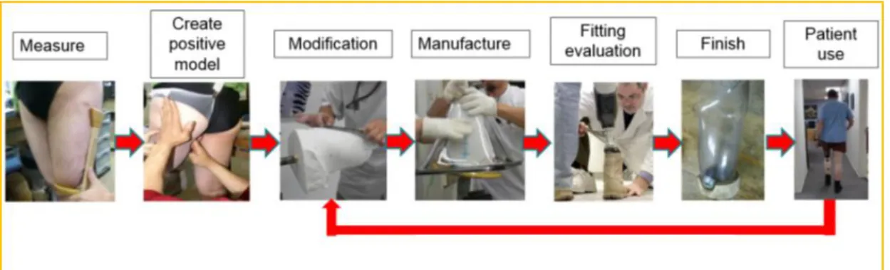 Figure 1.9 showed the conventional method to fabricate the prosthetic socket. 