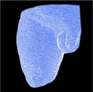 Figure 3.1 Residual Limb model created by LifeMOD TM