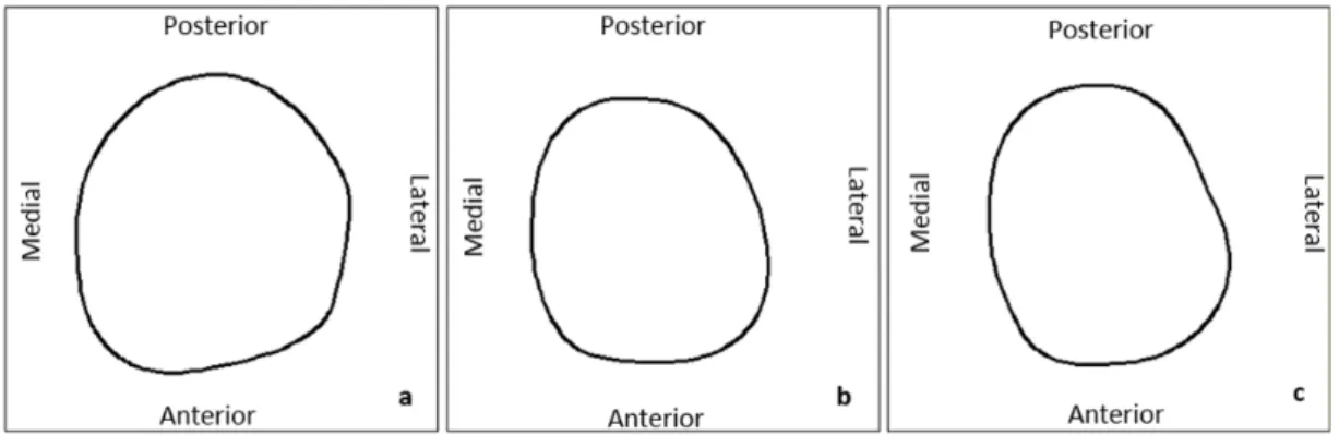 Figure 3.1: Profile at the cross section from distal end of (a) residual limb, (b) UCLA socket, and (c) MCCT socket at 180 mm