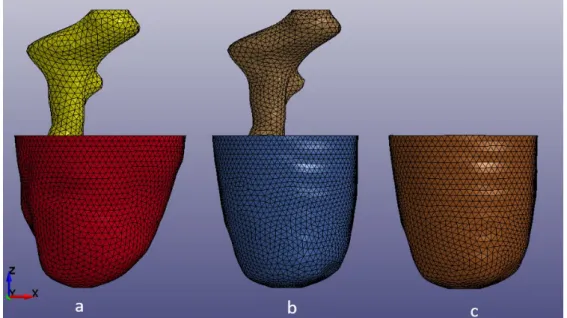 Figure 3.4: The FE model of residual limb in case of different shape with MCCT socket (a); same shape with MCCT socket (b) and the socket (c).