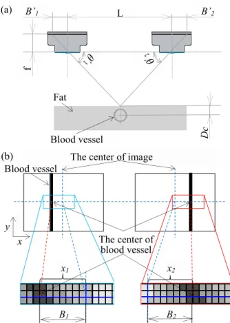 Fig. 3. Schematic of light-section method when incident  light is reflected by the forearm vein