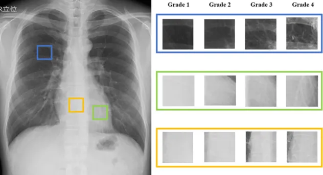 Table 6 shows both the EI values and the number of images de- de-termined to be appropriate or inappropriate using the DCNN and the created rule base.