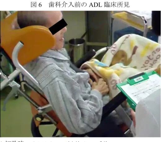 図 6    歯科介入前の ADL 臨床所見