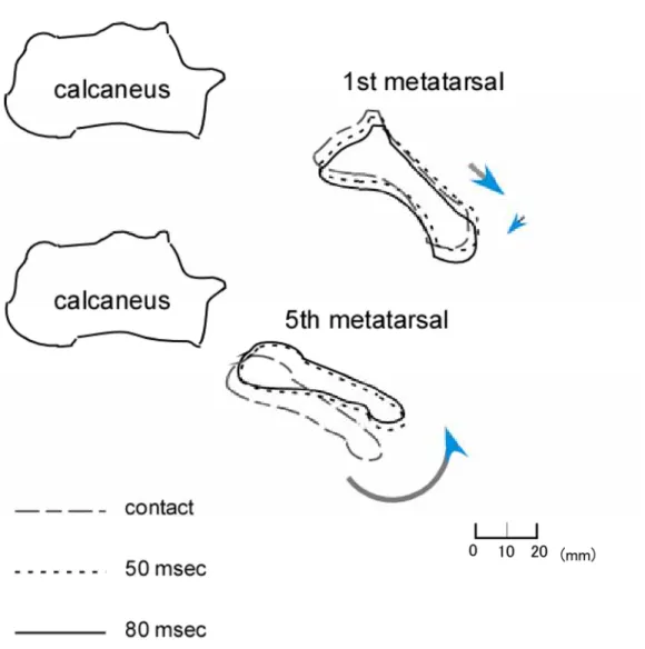 Figure 6. Motion difference of the first and fifth metatarsals with respect to the  calcaneus on a sagittal view