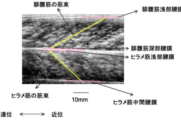 図 1-1 ．腓腹筋内側頭およびヒラメ筋の超音波縦断画像