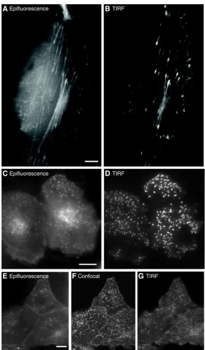 Figure 2-3. Comparison of epifluorescence image and TIRF image; Epifluorescence image  (A) and TIRF fluorescence image (B) of actin in MDCK cells