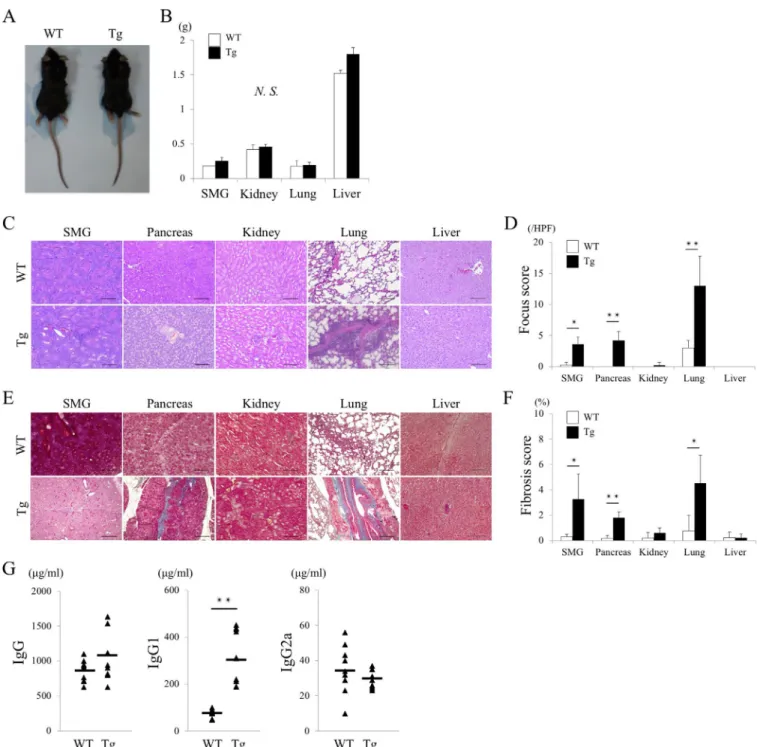 Figure 4.  Pathologic and serologic findings in human TLR- 7–transgenic/mouse TLR- 7–deficient (huTLR- 7–transgenic/mTLR- 7 −/− ) mice on a  C57BL/6 background