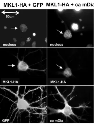 Fig. 6 Effect of C3 transferase on nuclear translocation of MAL induced by constitutively active mDia