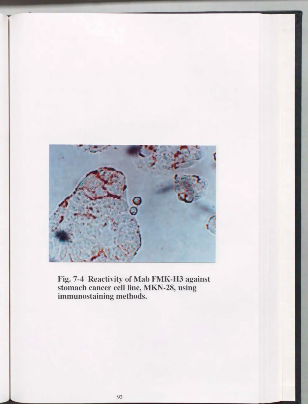 Fig.  7-4  Reactivity  of Mab  FMK・H3 against  stomach  cancer  cell line，  MKN・.28， using  immunostaining methods
