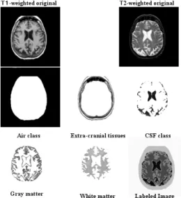 Fig. 6. The example of the final labeling results after  fuzzy reasoning (for slice 34)