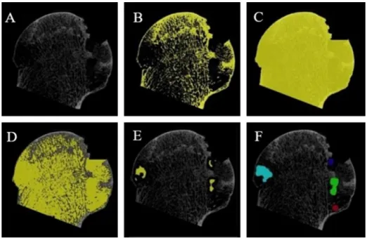 Fig. 1. Quantiﬁcation of bone-resorptive areas deﬁned as spaces ≥ 1 mm in diameter using bone microstructure measurement software (TRI/3D-BON, Ratoc System Engi- Engi-neering, Tokyo, Japan)