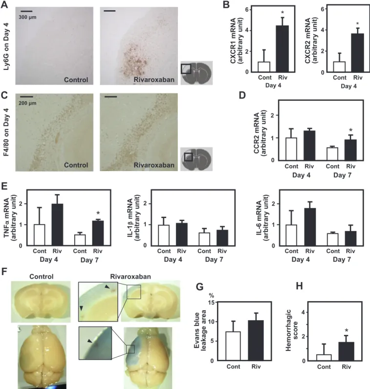 Fig. 4. Eﬀects of rivaroxaban initiation immediately after pMCAO on inﬂammatory responses in ischemic areas