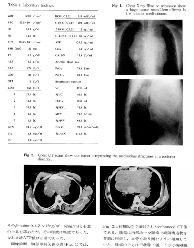 Table  1.  Laboratory  findings. Fig.  1.  Chest  X-ray  films  on  admission  show