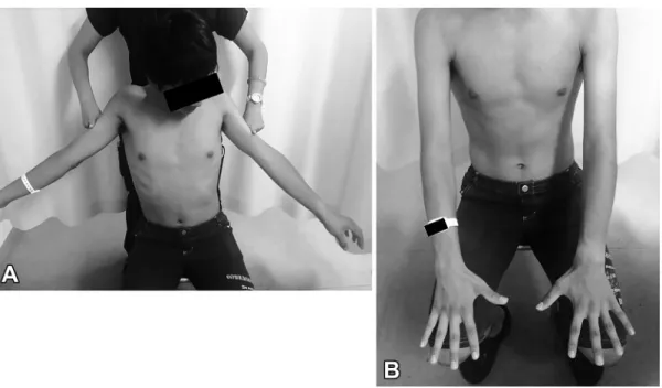 Fig. 2 Lateral cervical spine radiograms in the flexion position and the neutral position without degenerative changes and a spinal canal stenosis.