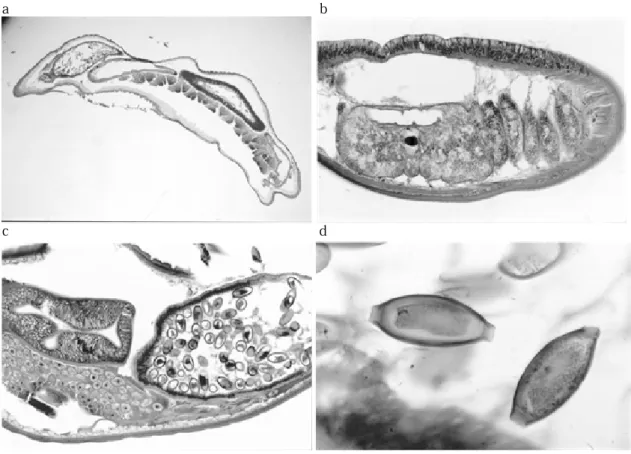 図 5　鞭虫の顕微鏡写真（H-E 染色） 　a. 虫体，b. 消化管，c. 卵巣，d. 虫卵 　また，盲腸にみられた寄生虫は鏡検にて鞭虫と診断さ れた（図５a-d）．虫体の食道は sticosome と呼ばれる特殊 な形態をしており（図５b），虫卵は岐阜提灯と形容され る特徴的な形をしていた（図 5d）． 　以上より，盲腸結核に合併した結核性腹膜炎および鞭 虫症と診断し，抗結核療法を施行した．鞭虫症に対して は駆虫療法を行った．その後組織培養より結核菌が検出 された． 　本例は中国人研修生であったが，その後