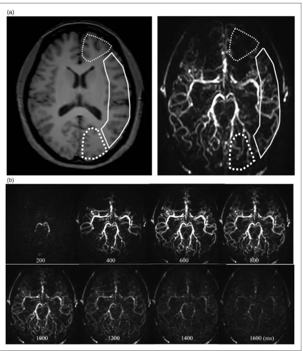 Figure 1. Multi-phase 4-dimensional magnetic resonance angiography images in a 24-year-old female volunteer