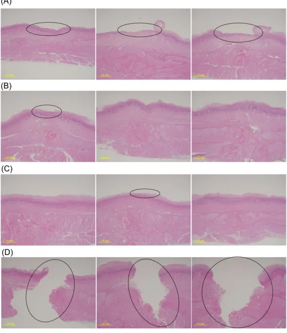 Figure 3 Pathological results for the 4 objects by EGHA-301-M. (A) PVDC-coated PVC PTP, (B) soft PThPa, (C) round PTP, (D) disposable scalpel.