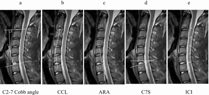 Figure 2. 	 Diagram of cervical spine sagittal magnetic resonance imaging showing five methods of measuring cervical spine alignment.