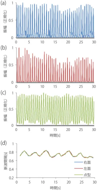 Fig. 11 PPG waveforms and peak-to-peak interval plot from participant 3, at condition 1