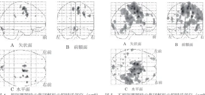 図 5   不規則課題時の集団解析の脳賦活部位（ n=9 ）前左前C  水平面 右右前左B  前額面A  矢状面図5  不規則課題時の集団解析の脳賦活部位（ n=9 ）前左前C  水平面 右右前左B  前額面A  矢状面 表１　各課題時の脳内活動の比較（集団解析 n=9）