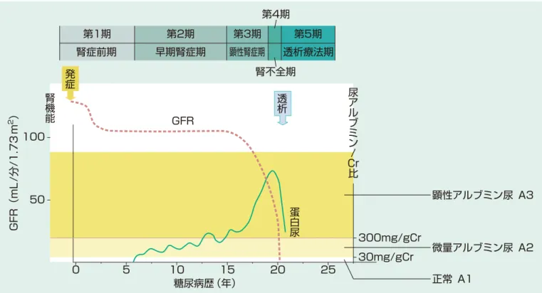 表　14　高齢者に多い腎疾患 一次性 二次性 泌尿器科疾患 糸球体疾患 膜性腎症 微小変化型ネフローゼ症候群 巣状分節性糸球体硬化症 IgA 腎症 糖尿病性腎症 顕微鏡的多発血管炎 （ANCA 関連血管炎）腎アミロイドーシス 肝炎ウイルス関連腎炎 血管性疾患 高血圧性腎症（腎硬化症） 腎動脈狭窄症（動脈硬化症） コレステロール塞栓症 虚血性腎症 尿細管間質疾患 ・ 他 慢性間質性腎炎 骨髄腫腎痛風腎 薬剤性腎障害 前立腺肥大症 （腎後性腎不全）尿路結石腎尿路悪性腫瘍図　19　2 型糖尿病性腎症の臨床経過 （