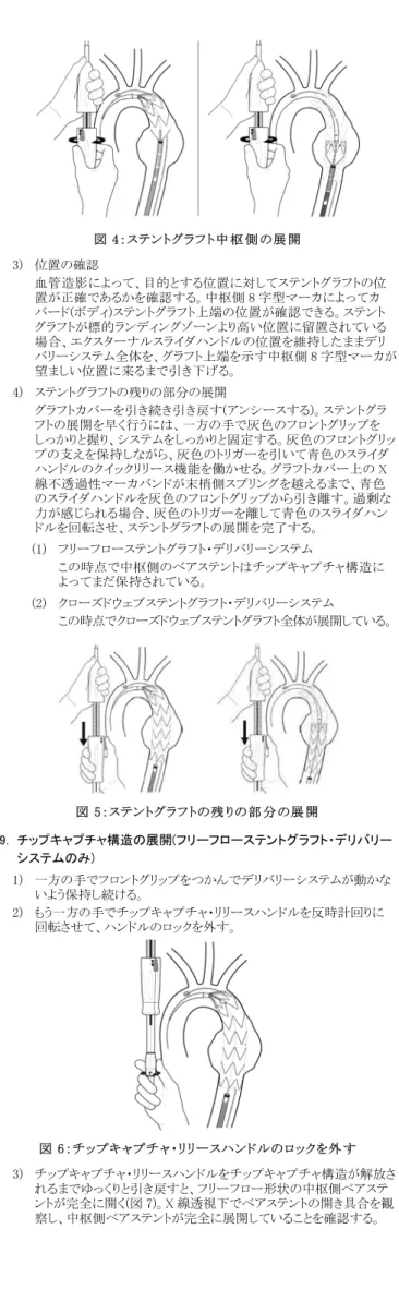 図 4：ステントグラフト中 枢 側 の展 開   3)  位置の確認  血管造影によって、目的とする位置に対してステントグラフトの位 置が正確であるかを確認する。中枢側 8 字型マーカによってカ バード(ボディ)ステントグラフト上端の位置が確認できる。ステント グラフトが標的ランディングゾーンより高い位置に留置されている 場合、エクスターナルスライダハンドルの位置を維持したままデリ バリーシステム全体を、グラフト上端を示す中枢側 8 字型マーカが 望ましい位置に来るまで引き下げる。  4)  ステントグラフ